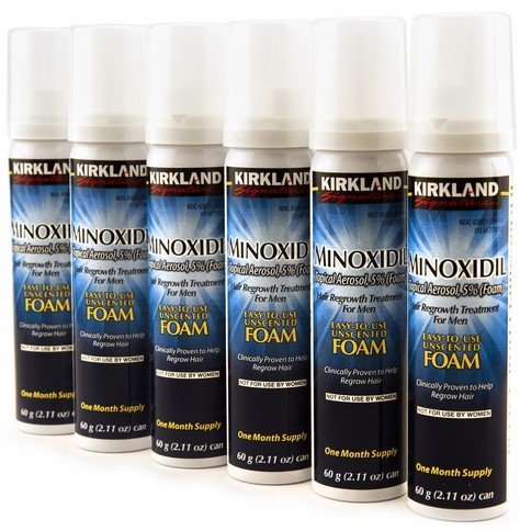 best minoxidil product | Kirkland Signature Minoxidil Treatment