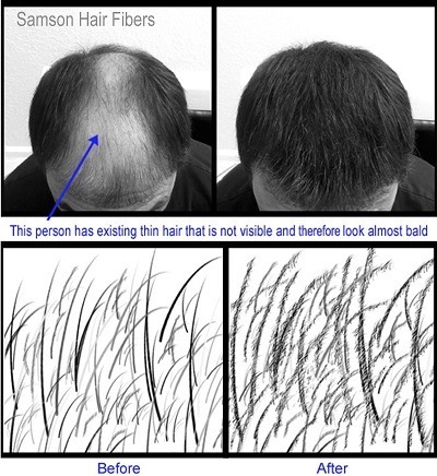 Best Hair Loss Concealers