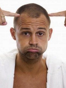 Receding Hair Line - Hair Loss Cure