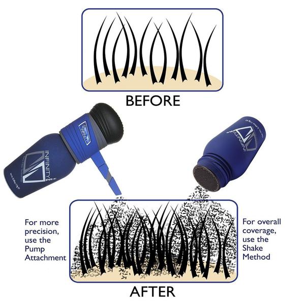 Best Hair Loss Concealers | Infinity hair loss concealing nano fibers